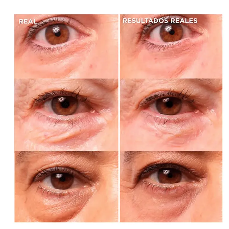 ITC BYE BYE UNDER EYE BAGS 15 ML