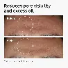 The Ordinary Niacinamide 10% + Zinc 1% Sérum Facial 30 ml