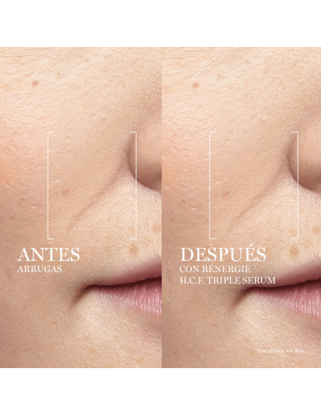 LANCOME RENERGIE H.C.F. TRIPLE SERUM