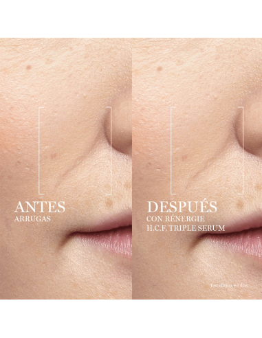 LANCOME RENERGIE H.C.F. TRIPLE SERUM